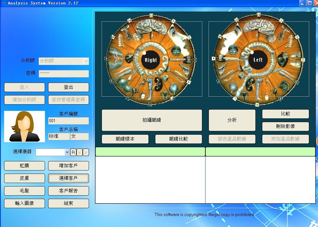 全新USB专用高清虹膜检测仪 5