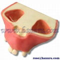 【Taiwan HANNRU- HR】Dental model PIM-13 Sinus Lift Implant Insertion 1