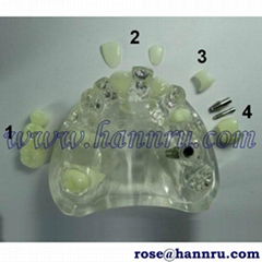 【Taiwan HANNRU- HR】DIM-41 Artificial Teeth Model