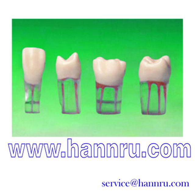 Endodontic Tooth Model