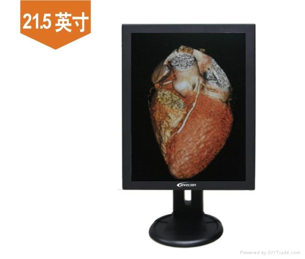 2M彩色醫用顯示器