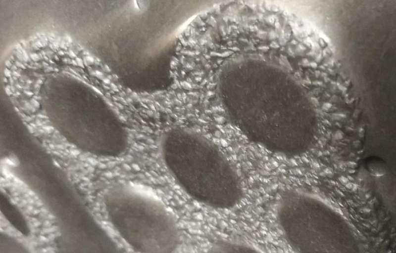 Metal matrix ceramic composite castings ceramic insert DJM (China