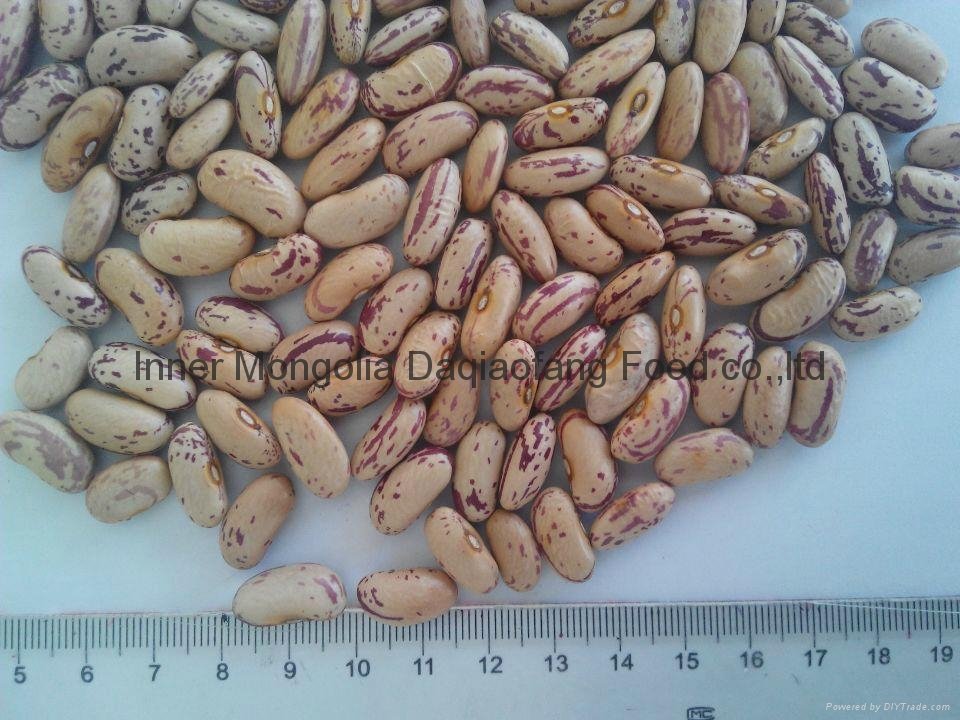Light Speckled kidney beans(long sharp) 5