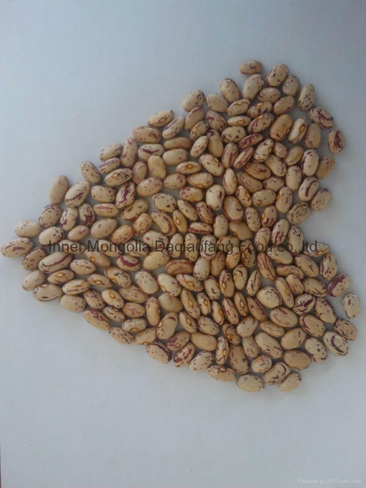 Light Speckled kidney beans(American round)
