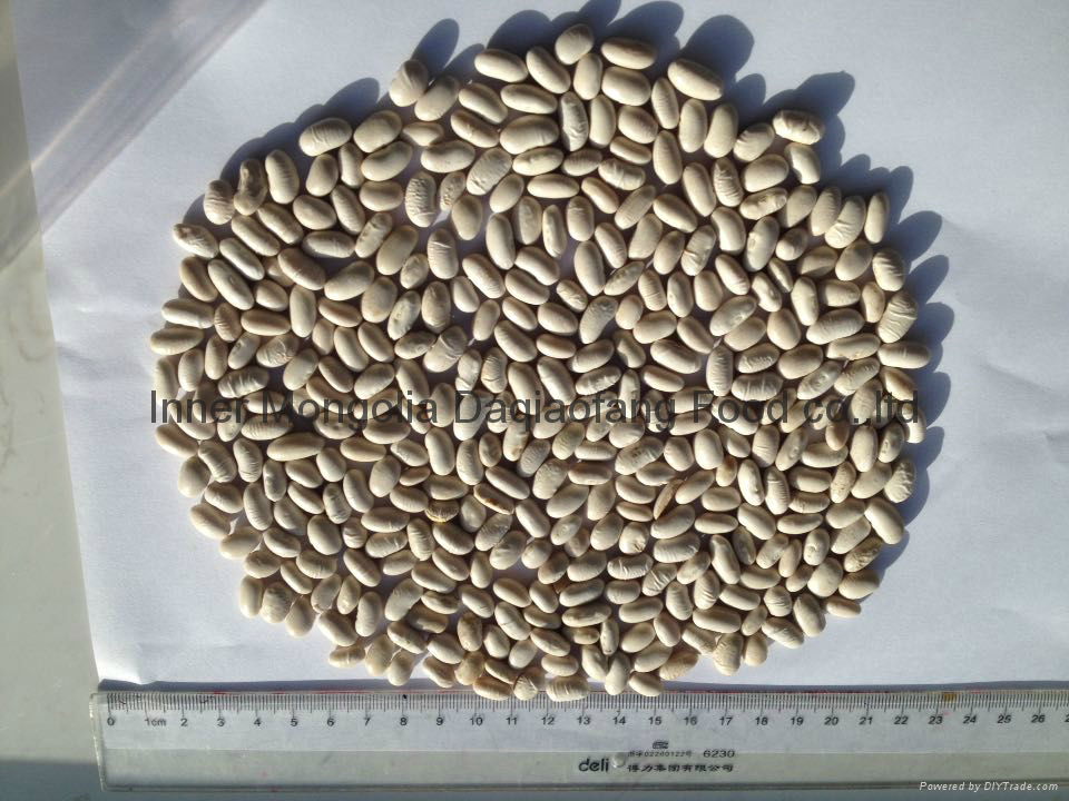 White kidney beans (Baishake type) 2