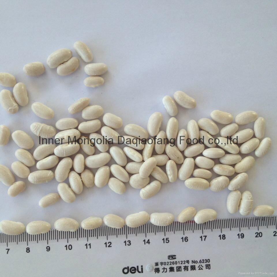 White kidney beans (Baishake type) 3