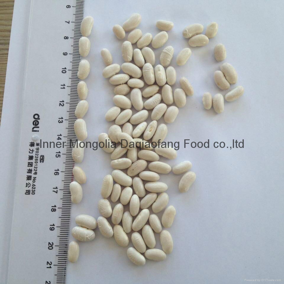 White kidney beans (Baishake type) 4