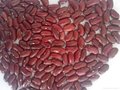 Dark red Kidney beans 3