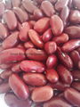 Dark red Kidney beans 5