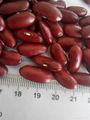 Dark red Kidney beans 4