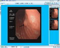 内窥镜影像工作站