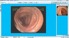 腸鏡影像工作站