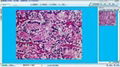 病理图文分析系统 1