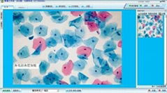 液基细胞检测报告系统