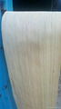 sell Recon veneer