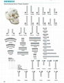 Maxillofacial Bone Plates trauma implant