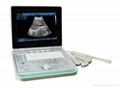 Laptop B/W Ultrasound Machine