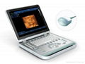 4D Laptop B/W Ultrasound Machine