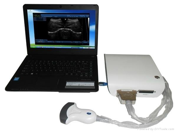 Ultrasound Box 2