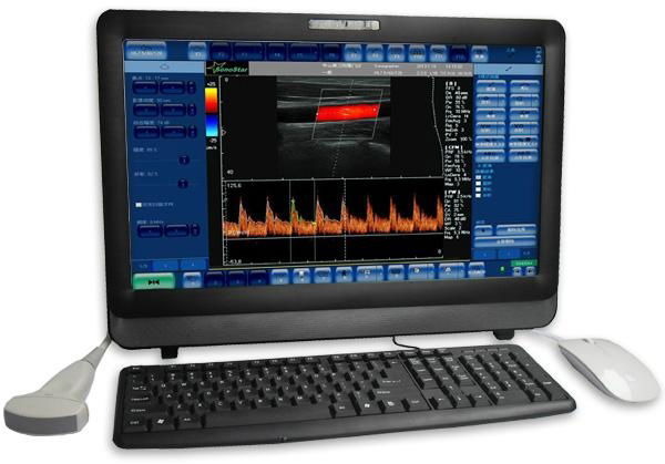 C8 22" Touch Screen Portable Color Doppler System 2