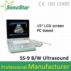 SS-9 Laptop B/W Ultrasound Scanner