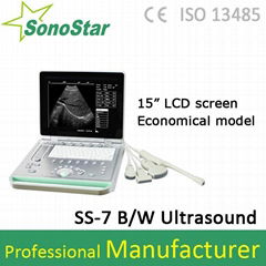 SS-7 Economical Laptop Ultrasound Scanner