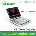 C5 Laptop Color Doppler Ultrasound