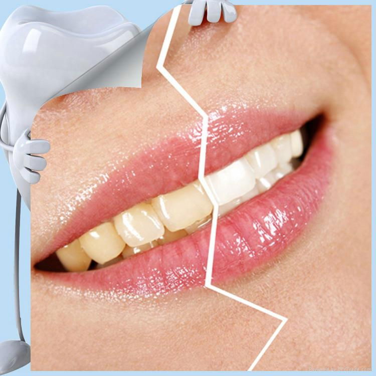 Instant Whites Wholesale Tooth Whitening Kits 4