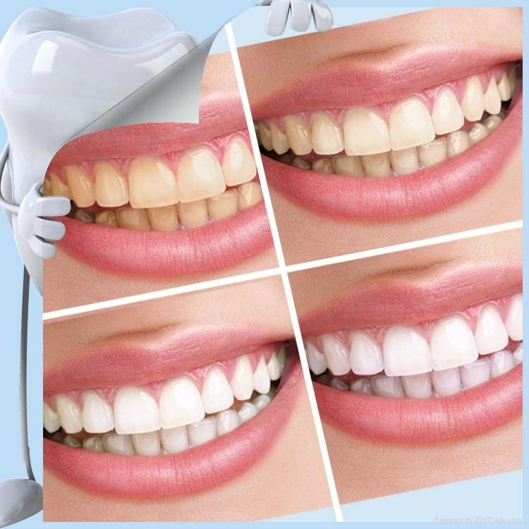 Marvel Select Wholesale Dental Product China Teeth Whitening Kit 4