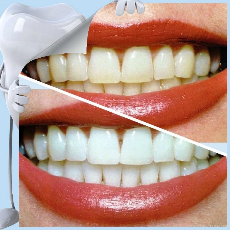 Medical Durban Innovative Product Private Label Teeth Whitening  2