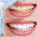 Usa Distributor Wanted Teeth Whitening Kits Private Logo 4