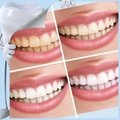 Express Printing Lables Teeth Whitening Novelty Packaging 4