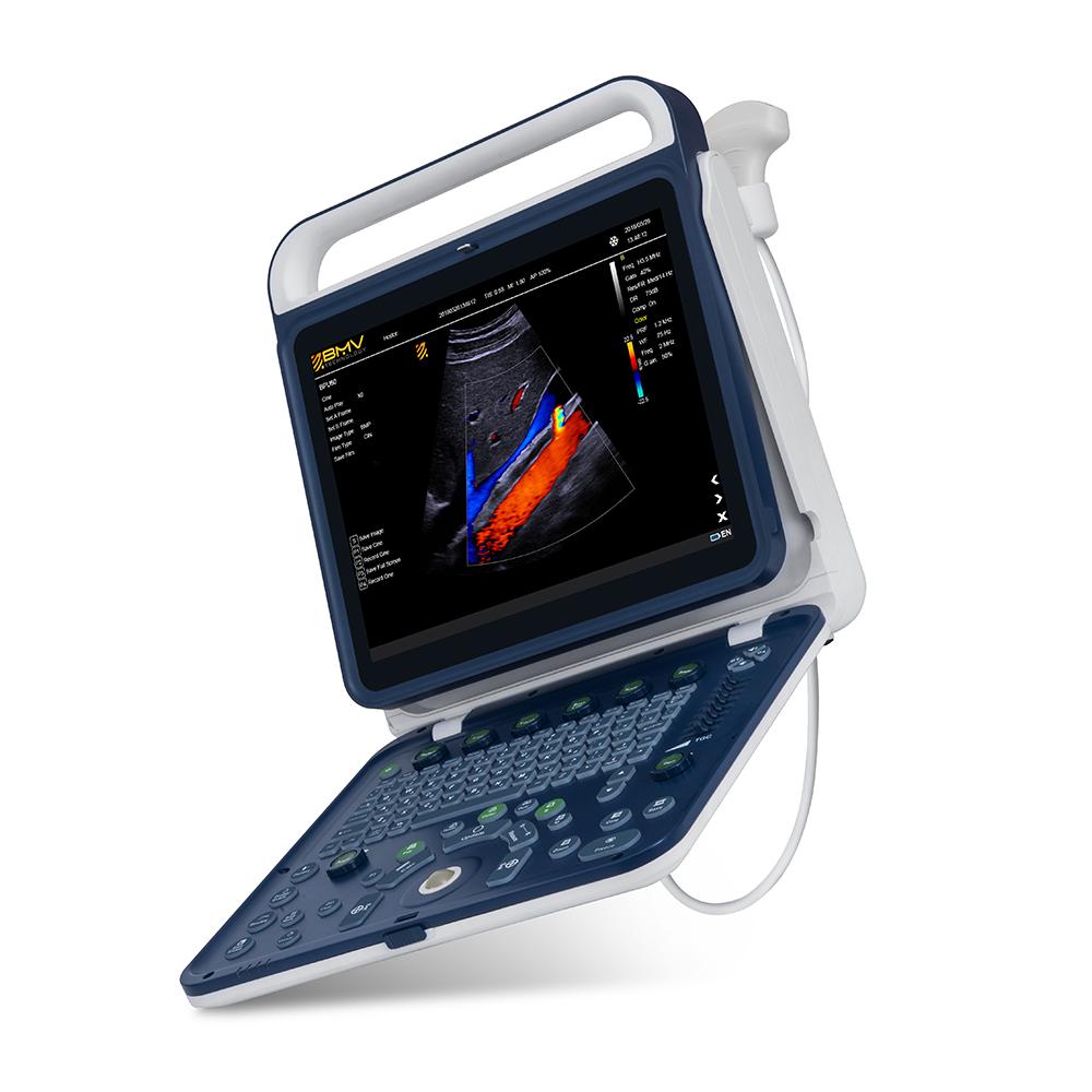 BPU60 Portable Color Doppler Ultrasound 2