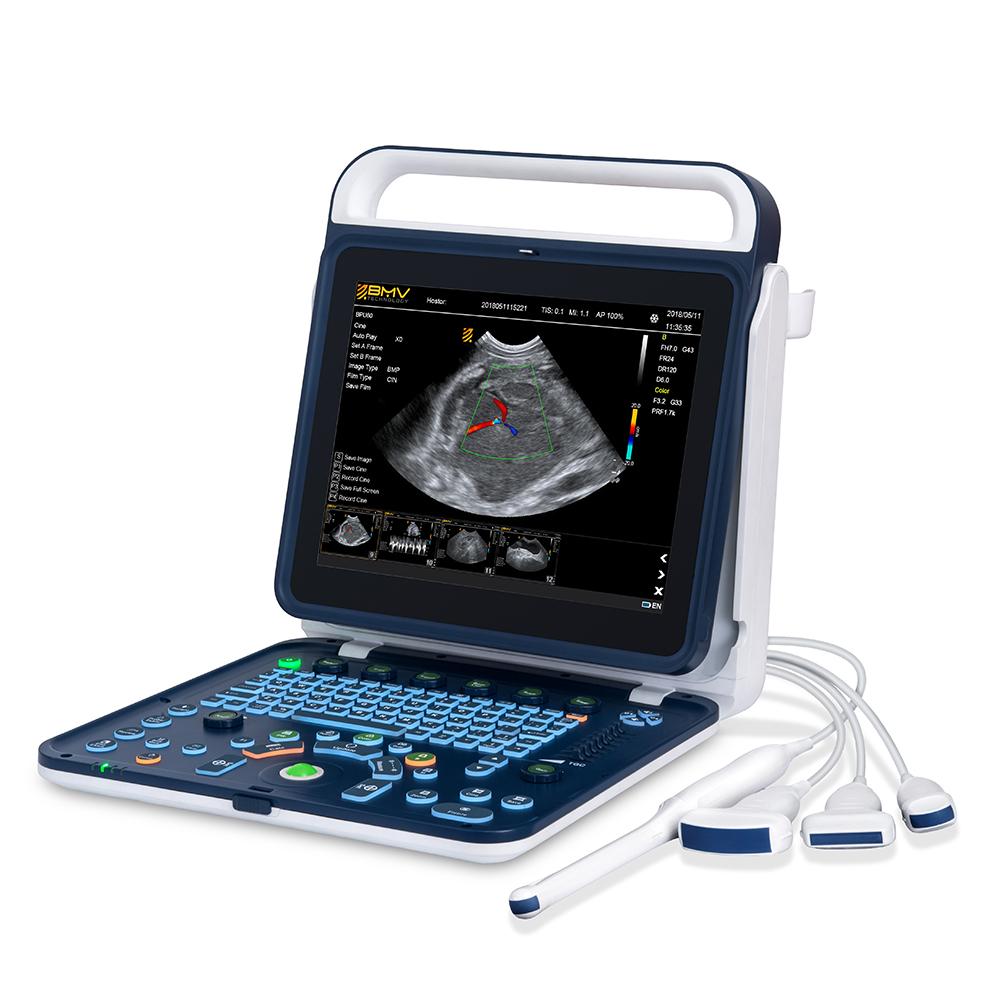 BPU60 Portable Color Doppler Ultrasound 3