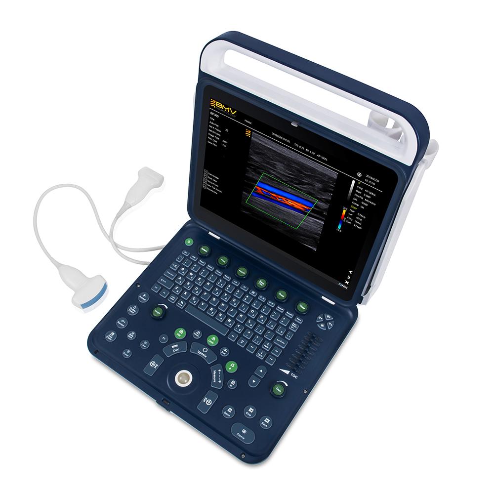 BPU60 Portable Color Doppler Ultrasound 4