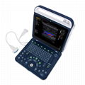 BPU60 Portable Color Doppler Ultrasound