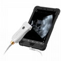 MX5 Go POC wireless Ultrasound scanner 2