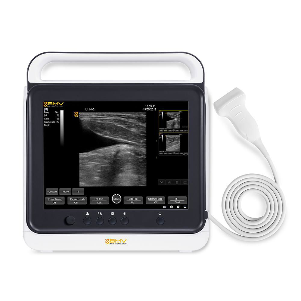 Touch screen B mode Cost-effective Hand-carried ultrasound system scanner 