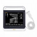 Touch screen B mode Cost-effective Hand-carried ultrasound system scanner  1