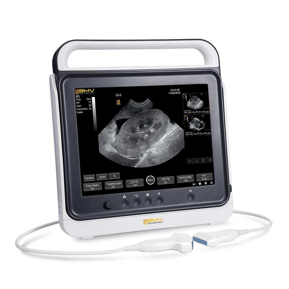 Touch screen B mode Cost-effective Hand-carried ultrasound system scanner  2