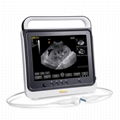 Touch screen B mode Cost-effective Hand-carried ultrasound system scanner 
