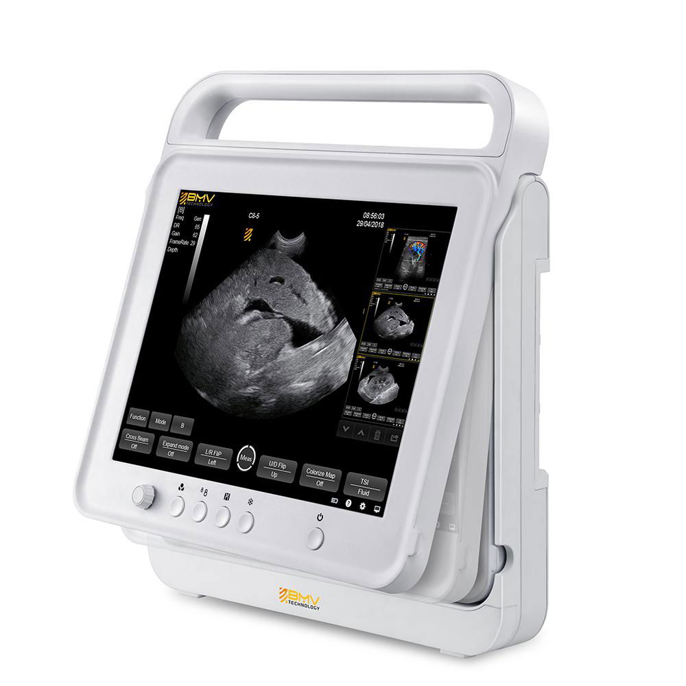 PT50 fully-featured touch veterinary ultrasound equipment 3