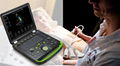 BCU-60 Vet Hand-Carried Color Doppler Ultrasound laptop type