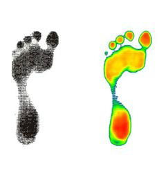  Plantar-Pressure-System-Podiascan 1