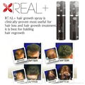 best hair regrowth REAL PLUS pilatory