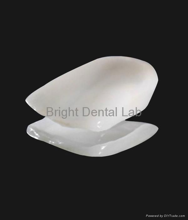 Dental Full ceramic Emax crowns and veneers 3