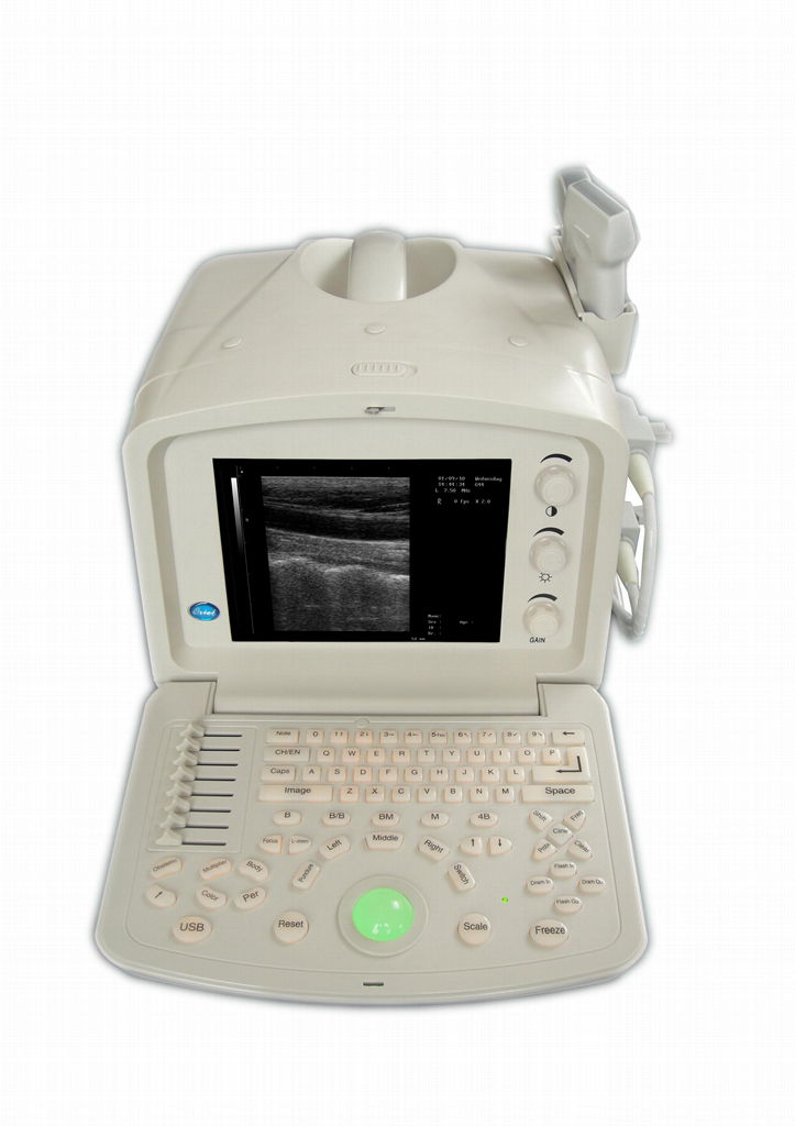 ATNL51353A Digital Portable Ultrasound Scanner 