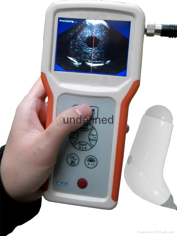  Family Used Bladder Ultrasound Scanner[Coming Soon]