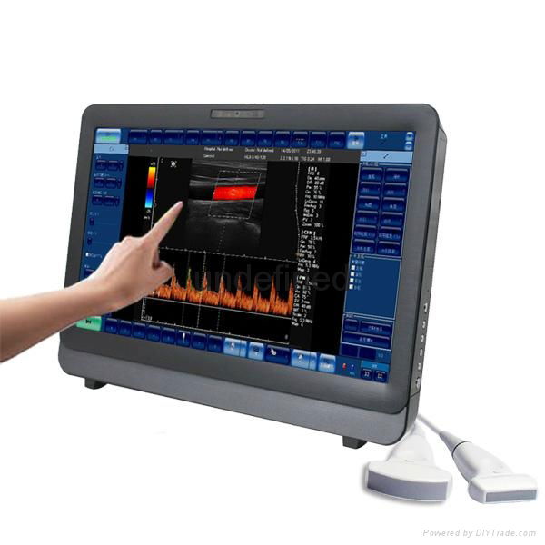  Touch of color doppler ultrasound 1