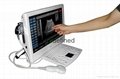 Touch Screen LCD Ultrasound Scanner(ultrasoni,black white,scanner)